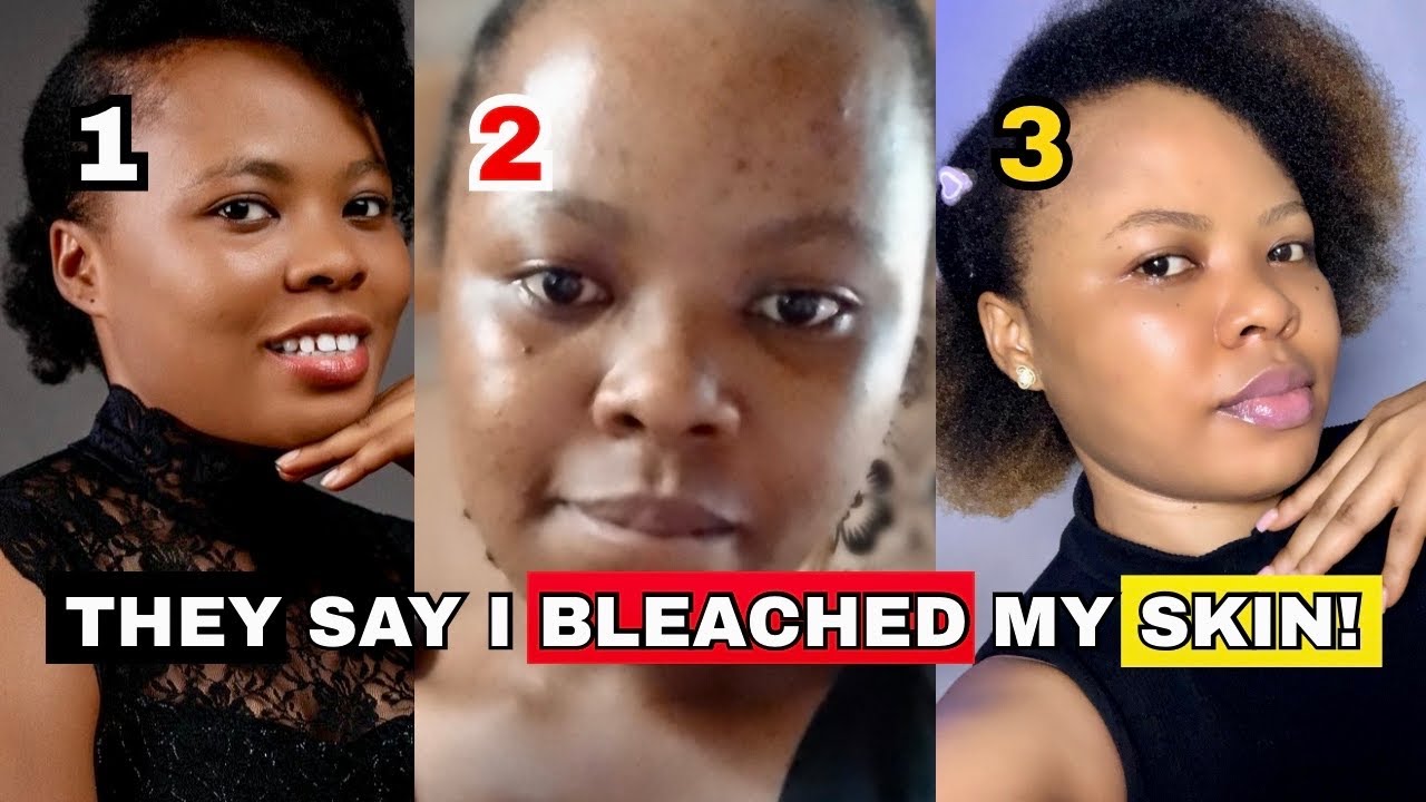 Did I BLEACH MY SKIN? How I Finally GOT MY FAIR SKIN