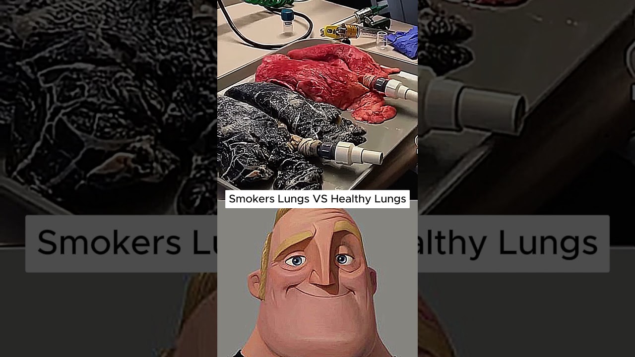 This Is What Smoking Does to Your Lungs&hellip; #Shorts