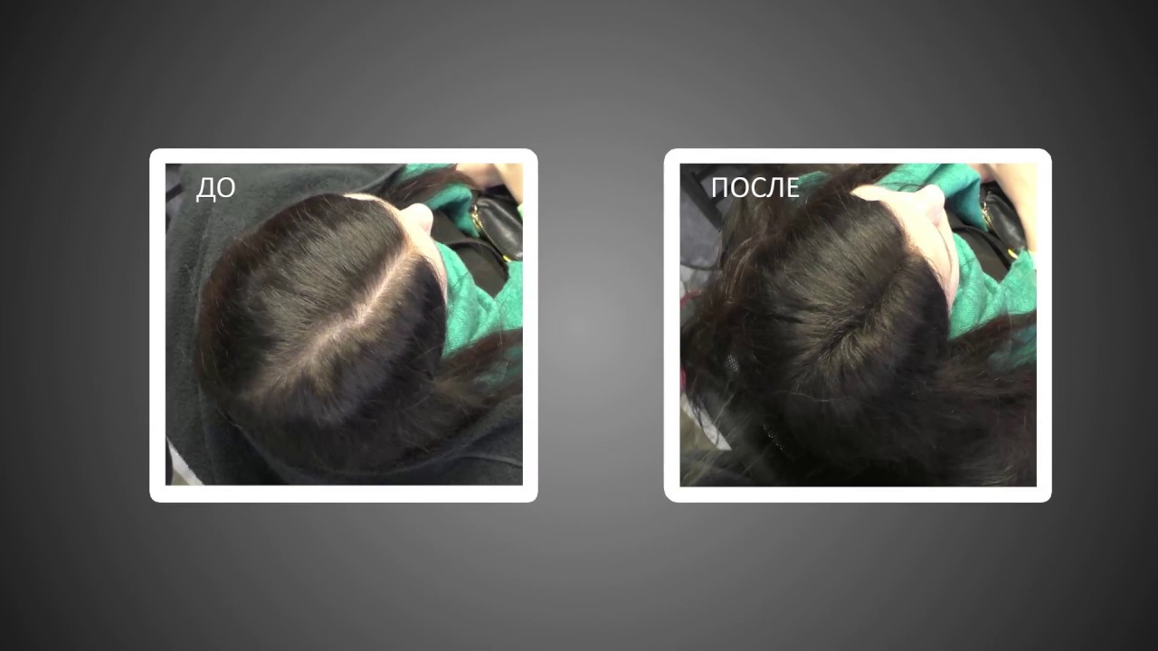Как сделать густые волосы за несколько секунд Super Million Hair