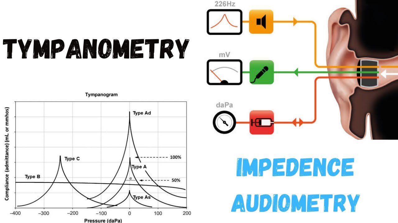 TYMPANOMETRY | Impedance Audiometry | Types of Tympanograms in easiest way