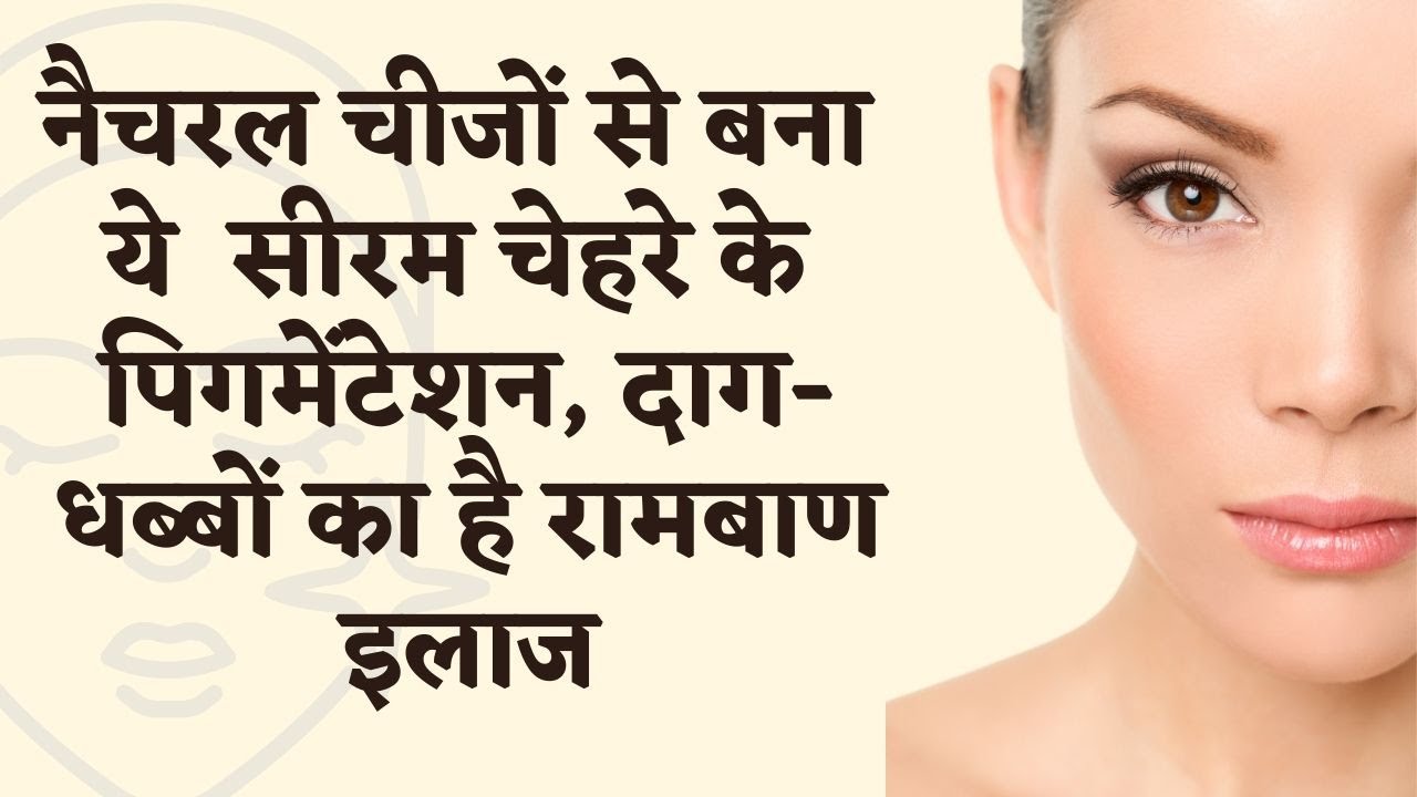 How To Get Rid of Hyper pigmentation - Freckles, Dark Spots, Melasma, Black Patches I DR. MANOJ DAS