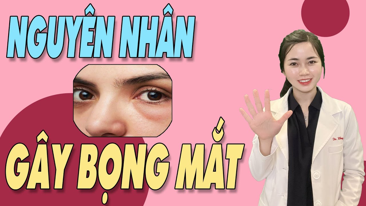 5 ĐIỀU khiến bạn dễ bị BỌNG MẮT và TRÔNG GIÀ ĐI hơn |Bs Nguyễn Ngọc