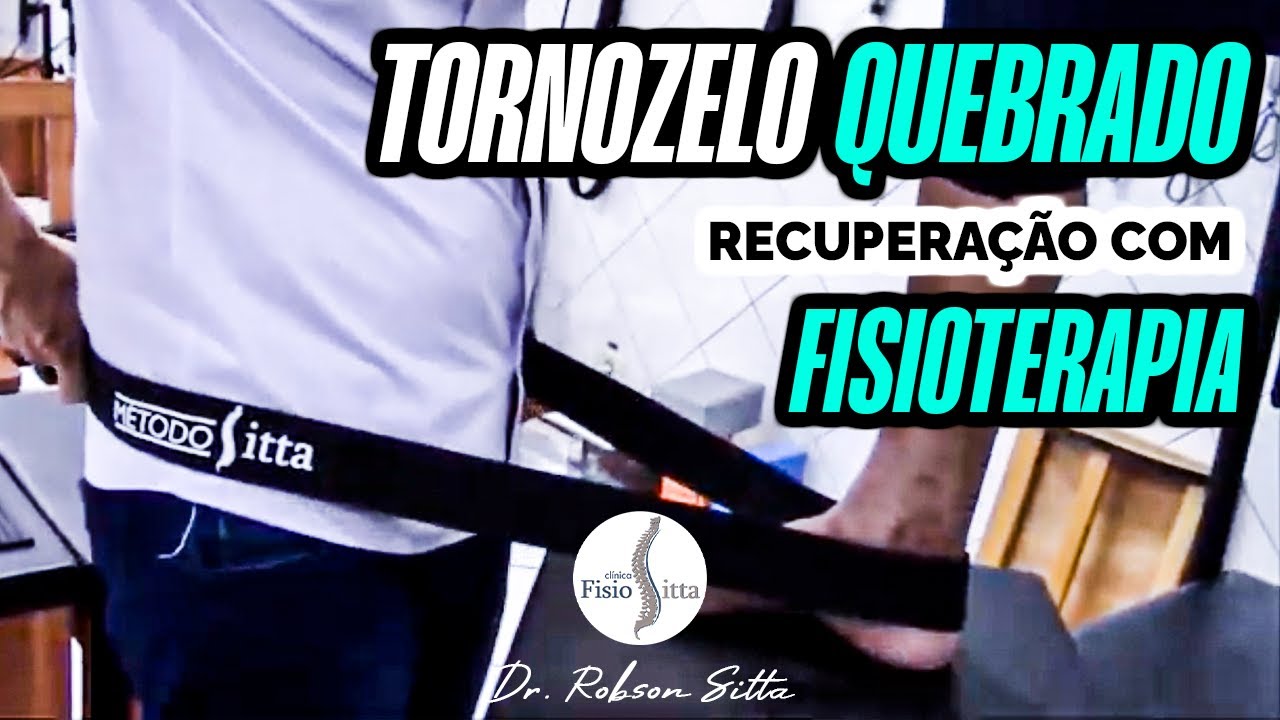 FRATURA TRIMALEOLAR TORNOZELO RECUPERAÇÃO DA CIRURGIA COM FISIOTERAPIA - Dr. Robson Sitta