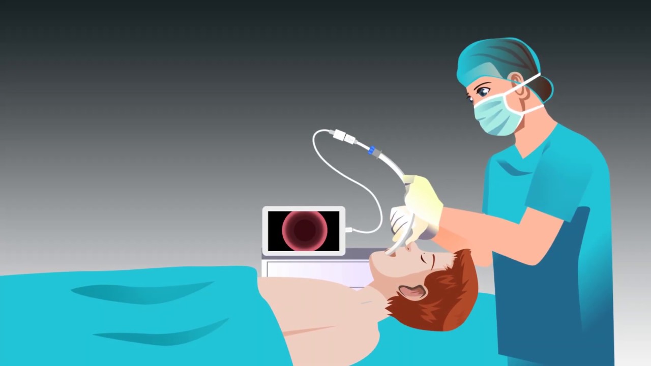 Safe-Cam -- disposable Video Stylet -- Explainer Video