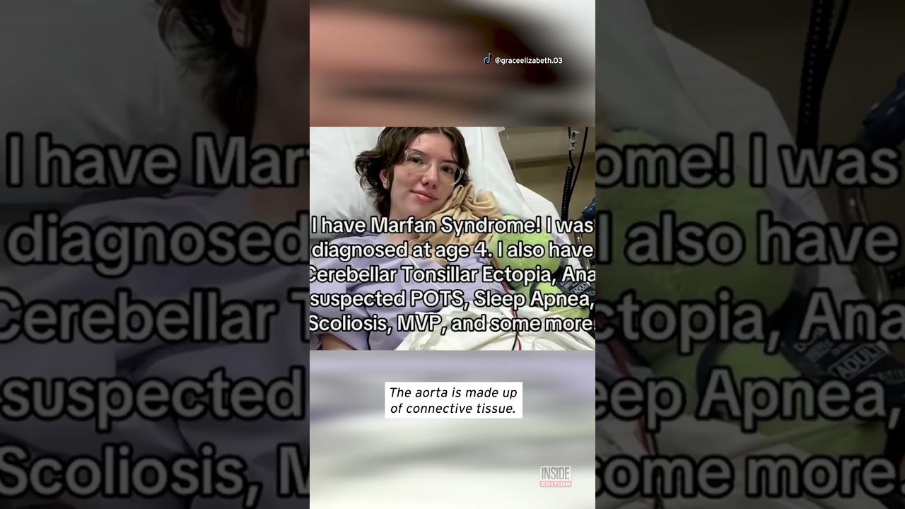 Woman With Marfan Syndrome Could Tear Aorta At Any Moment #shorts
