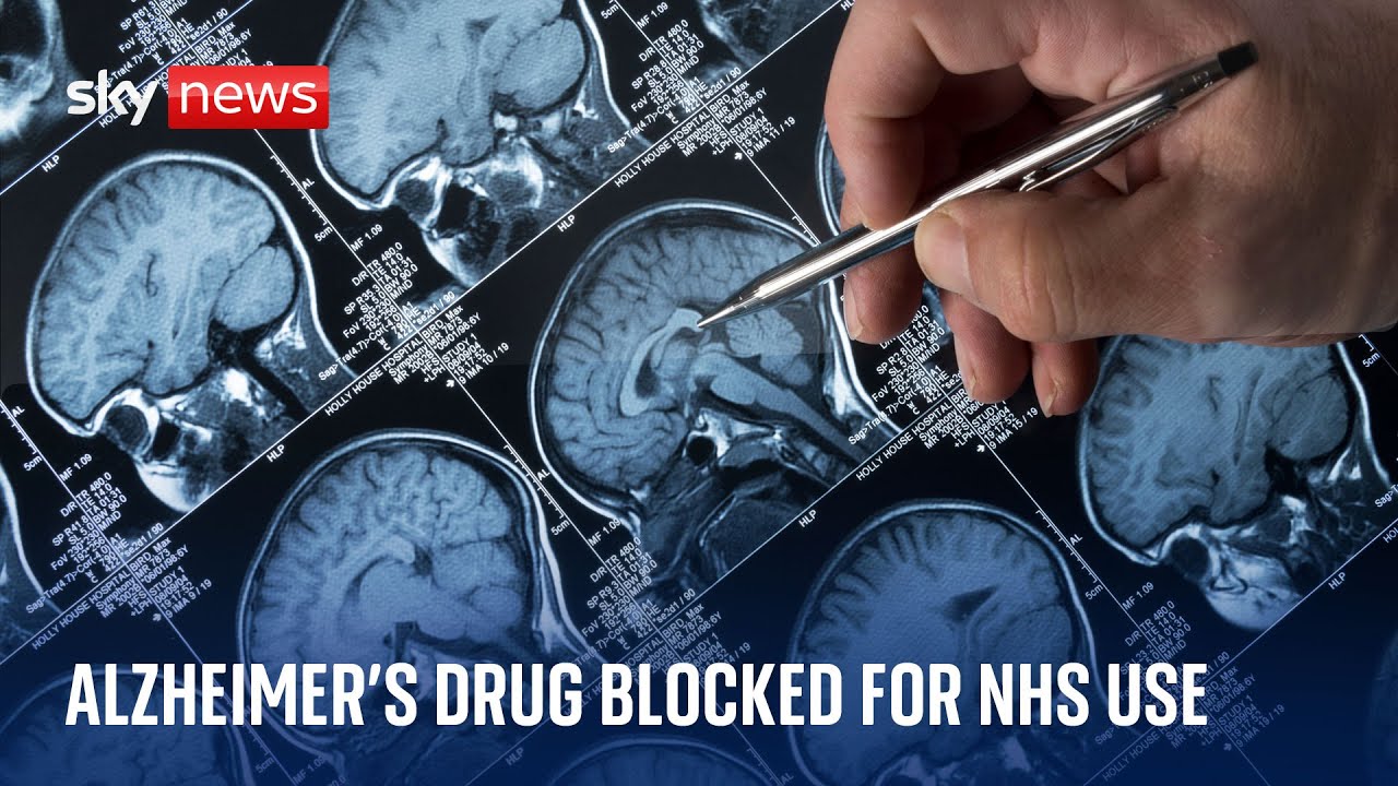 New Alzheimer’s drug rejected for widespread NHS use