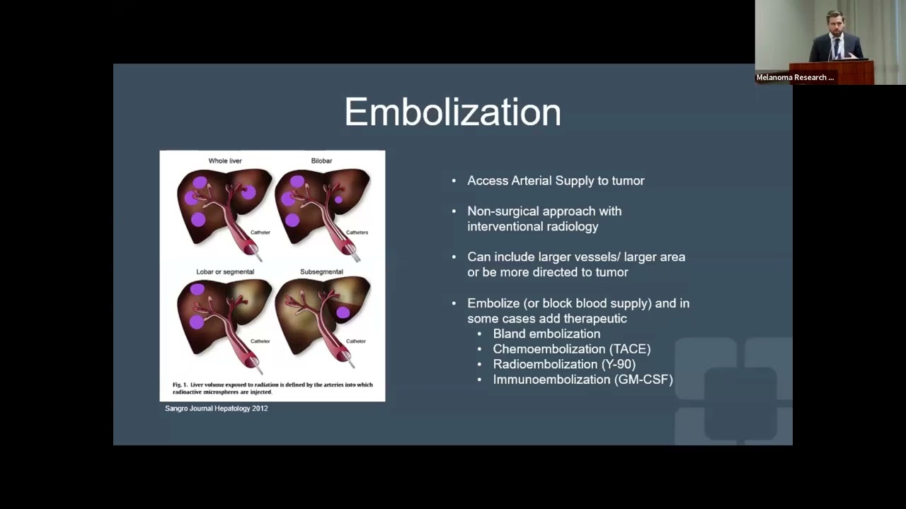 Metastatic Uveal Melanoma Treatment Sessions and Q&A