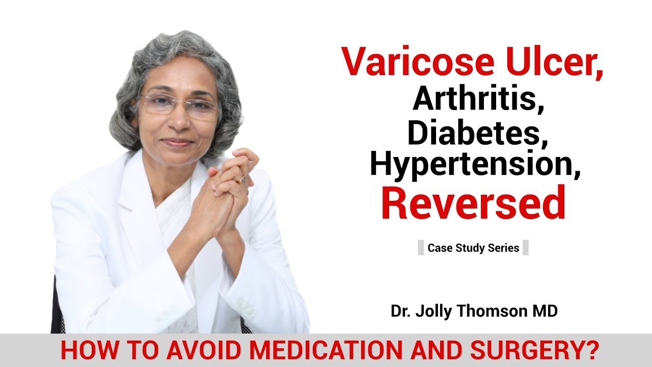 Varicose Ulcer, Arthritis, Diabetes, Hypertension-Reversed [Case Study]