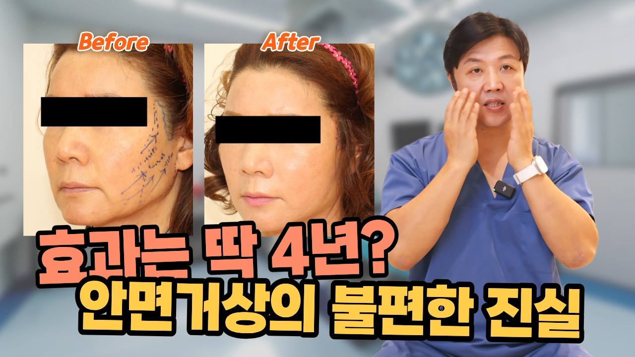 안면거상 수술의 충격적인 비밀...절대로 그냥 하지 마세요!! 제가 수술을 중단한 진짜 이유 3편