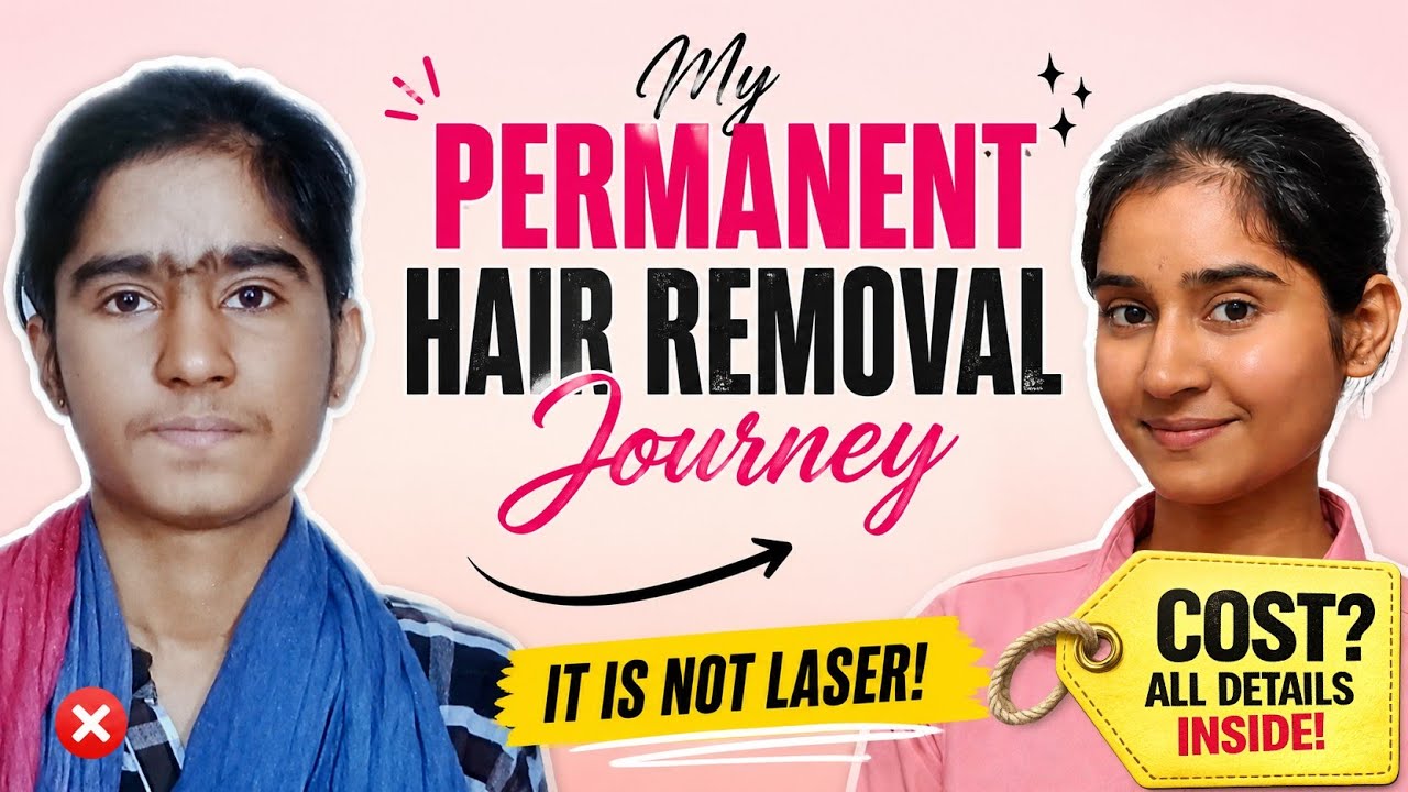Electrolysis for Facial Hair 😣 | Mera Real Experience, Pain, Cost & Results | Laser vs Electrolysis