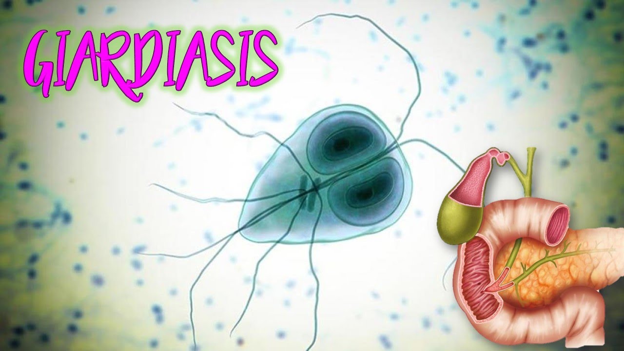 Giardiasis, el parásito de la sonrisa