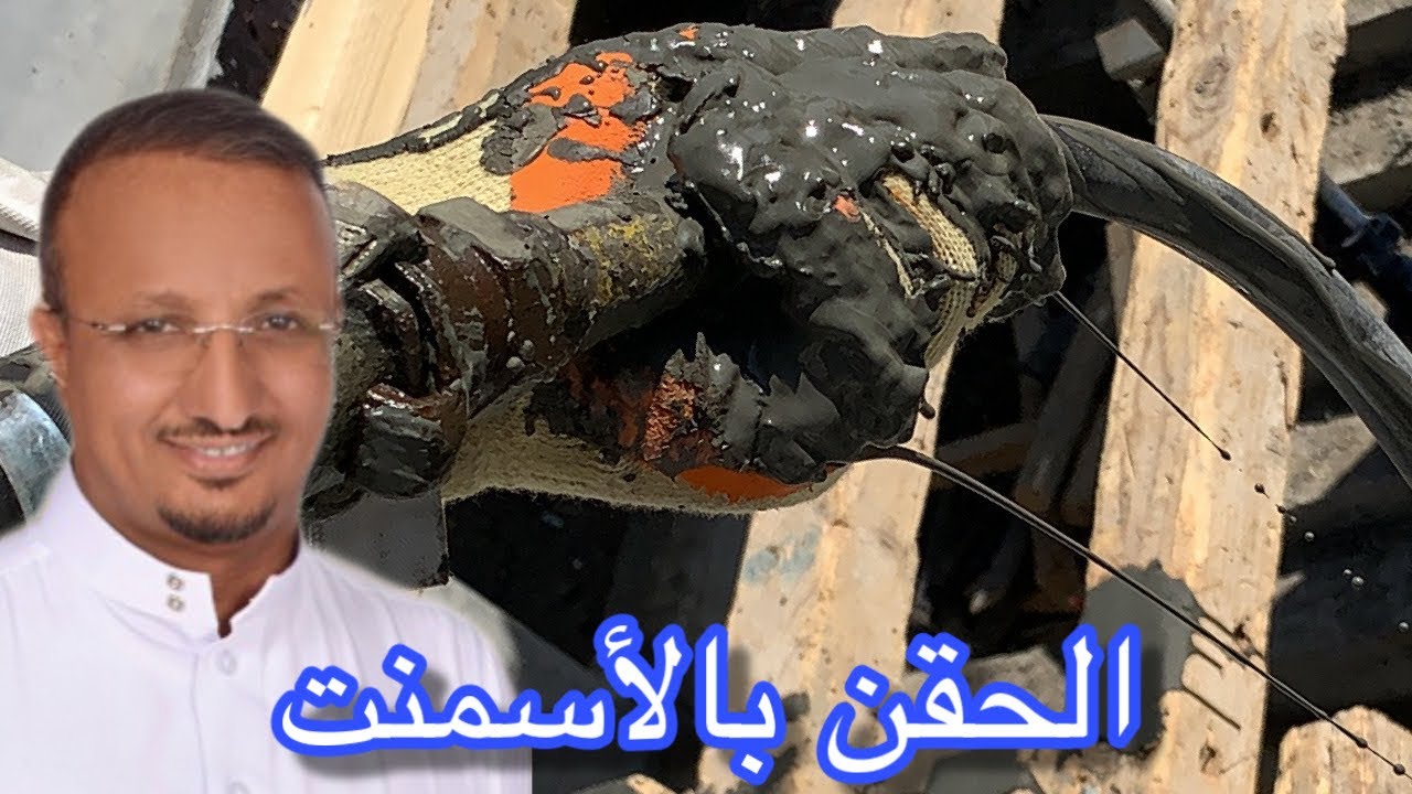 حقن السقف البوست تنشن