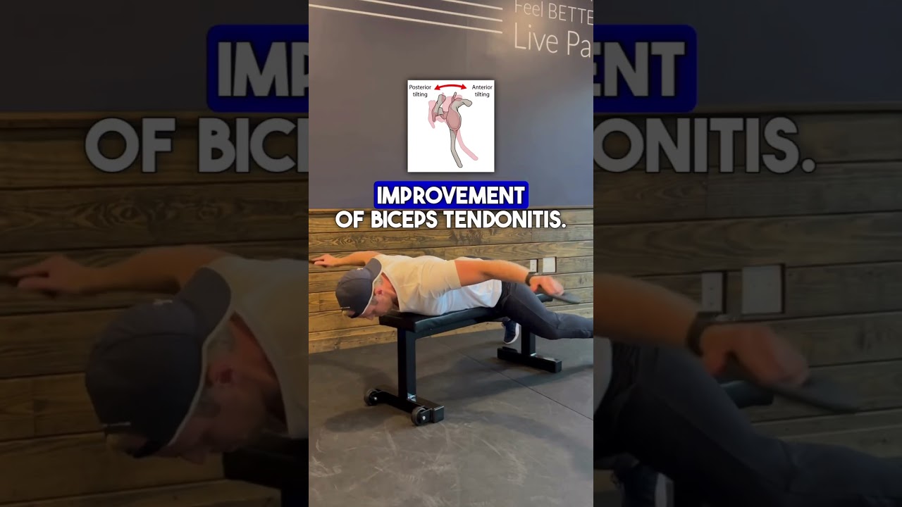Вылечите тендинит бицепса!