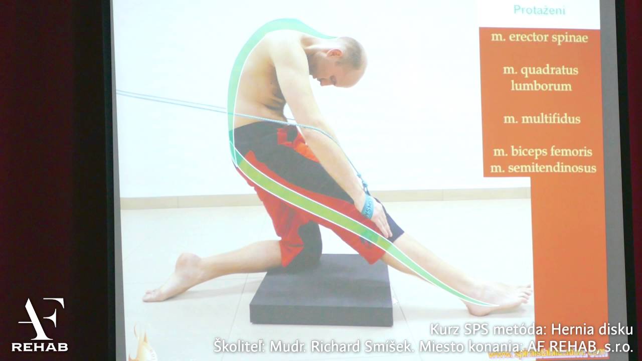 Hernia disku |5| MUDr. Richard Smíšek, SPS metóda (SM-Systém)