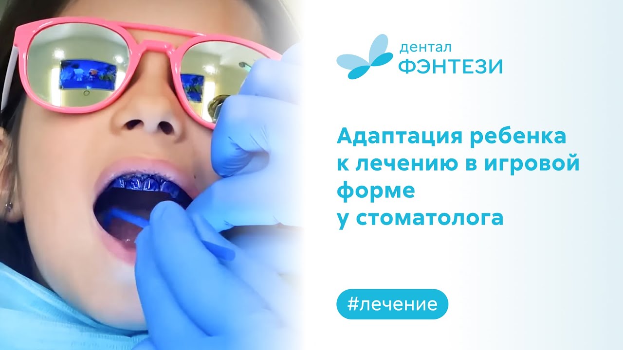 ✅ Адаптация ребенка к лечению в игровой форме у стоматолога
