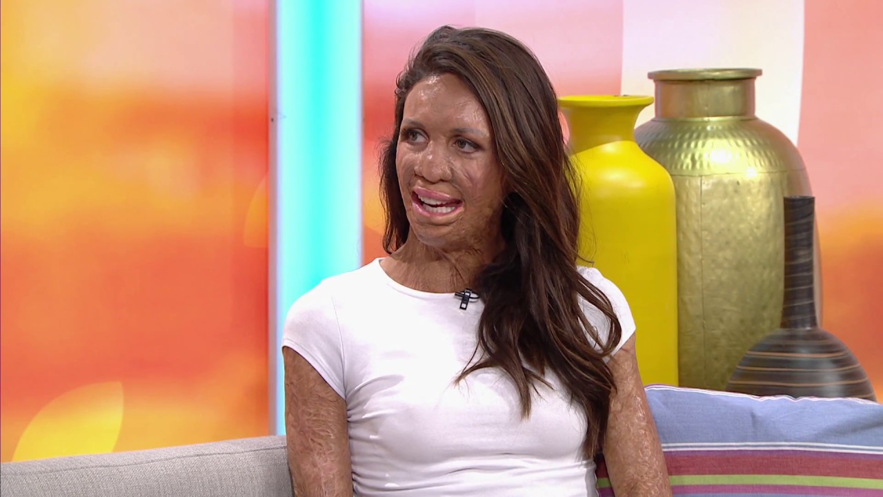 Turia Pitt on her passion for motherhood and life