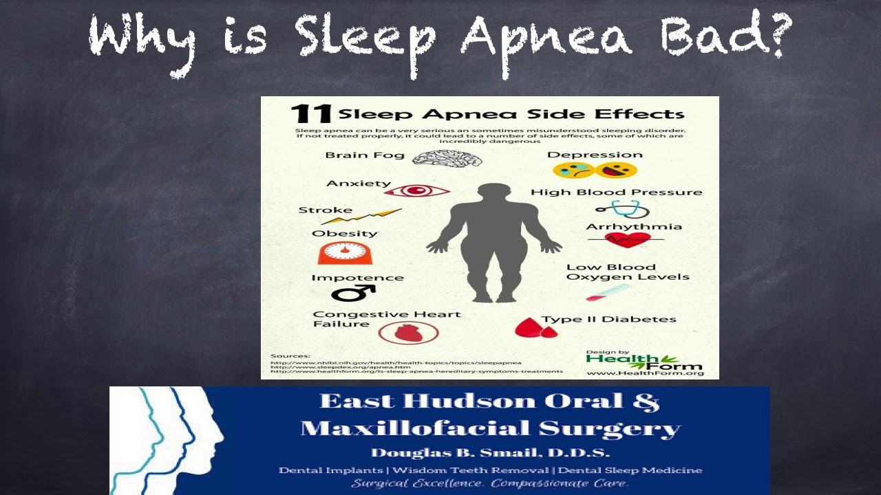 Patient Education Video Obstructive Sleep Apnea