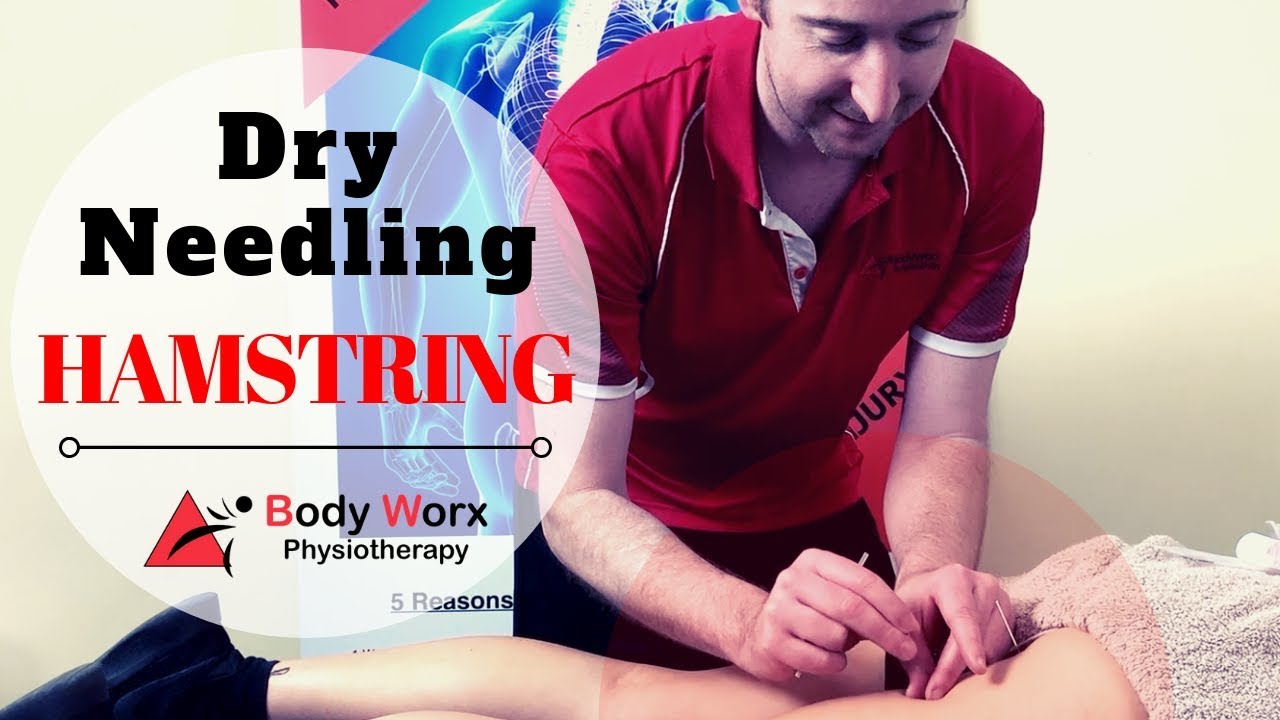 Dry Needling Hamstring - Jason Bradley BodyWorx Physio