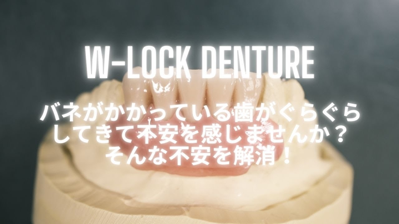 ばねがかかる歯に負担を与えない入れ歯。