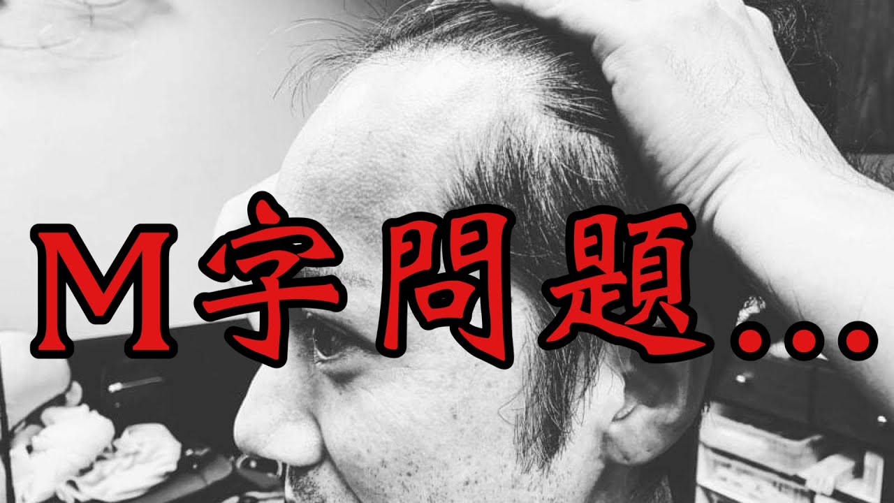 M字ハゲ 薄毛 広いおでこを目立たなくさせるカット