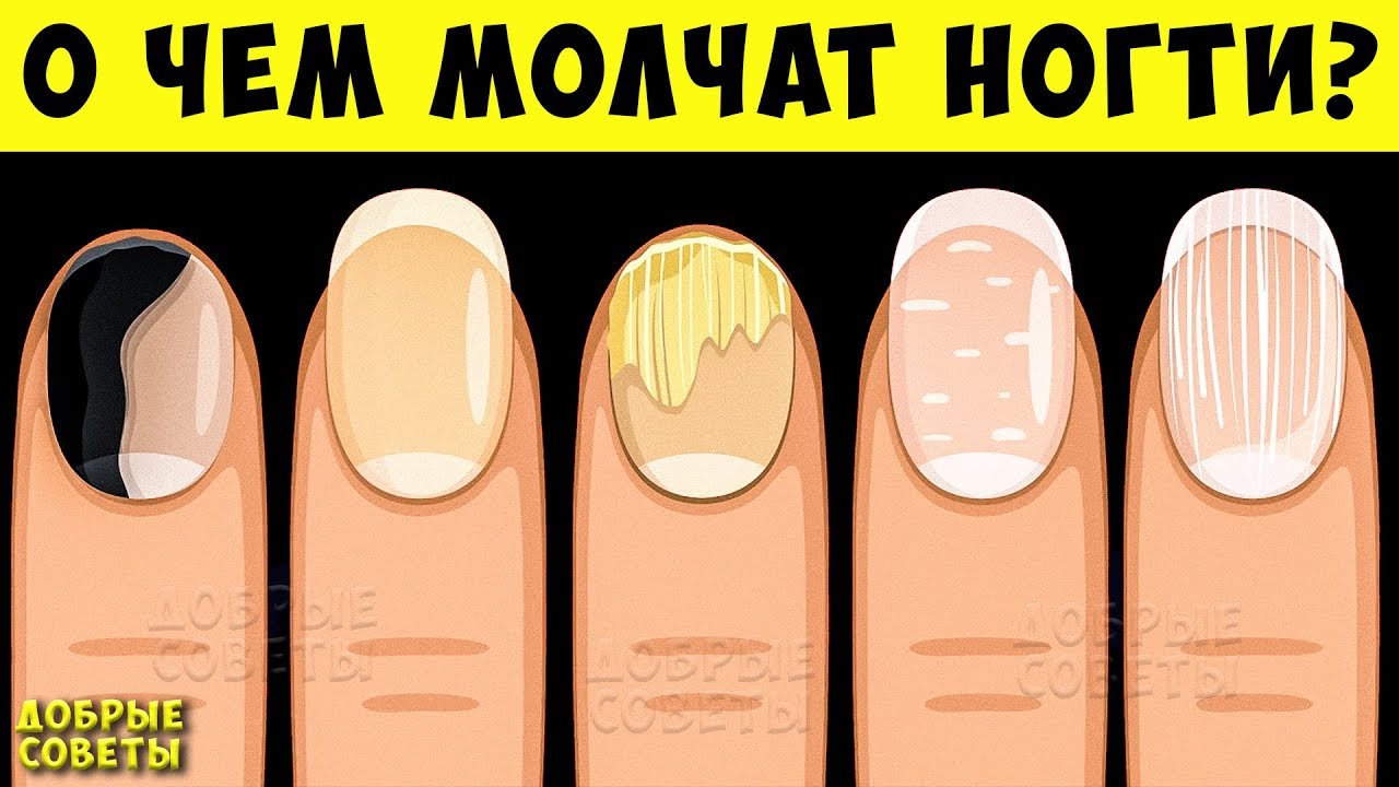 5 вещей по которым ваши Ногти могут рассказать Всё о вашем Здоровье