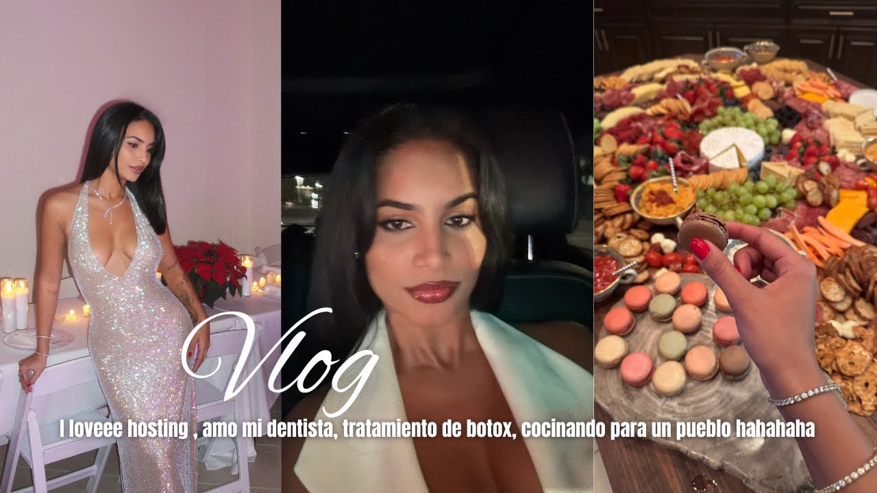 Vlog | Hostess with the mostest , el mejor pure de papasss, dentista, tratamiento de botox....