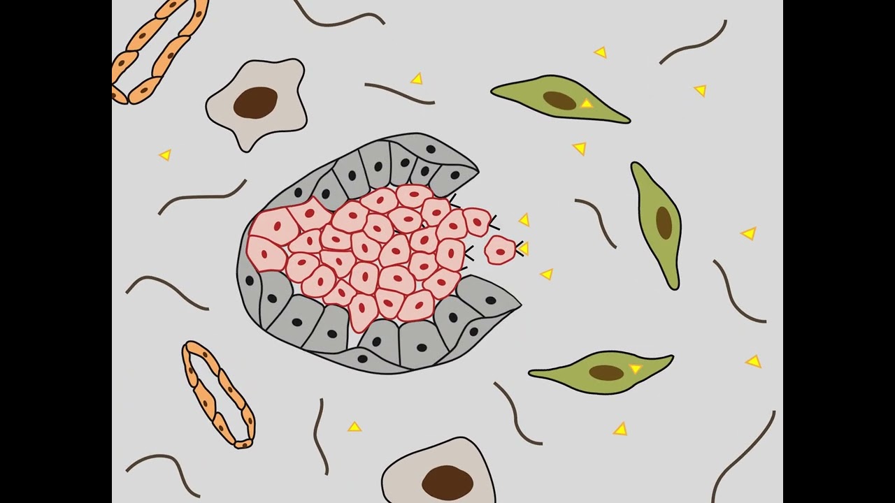 Communication of tumour cells with the microenvironment HD
