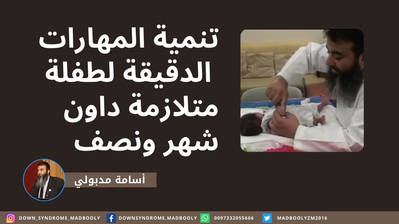 تنمية المهارات الدقيقة للابنة ريم شهر ونصف مع اسامة مدبولي , متلازمة داون Down Syndrome