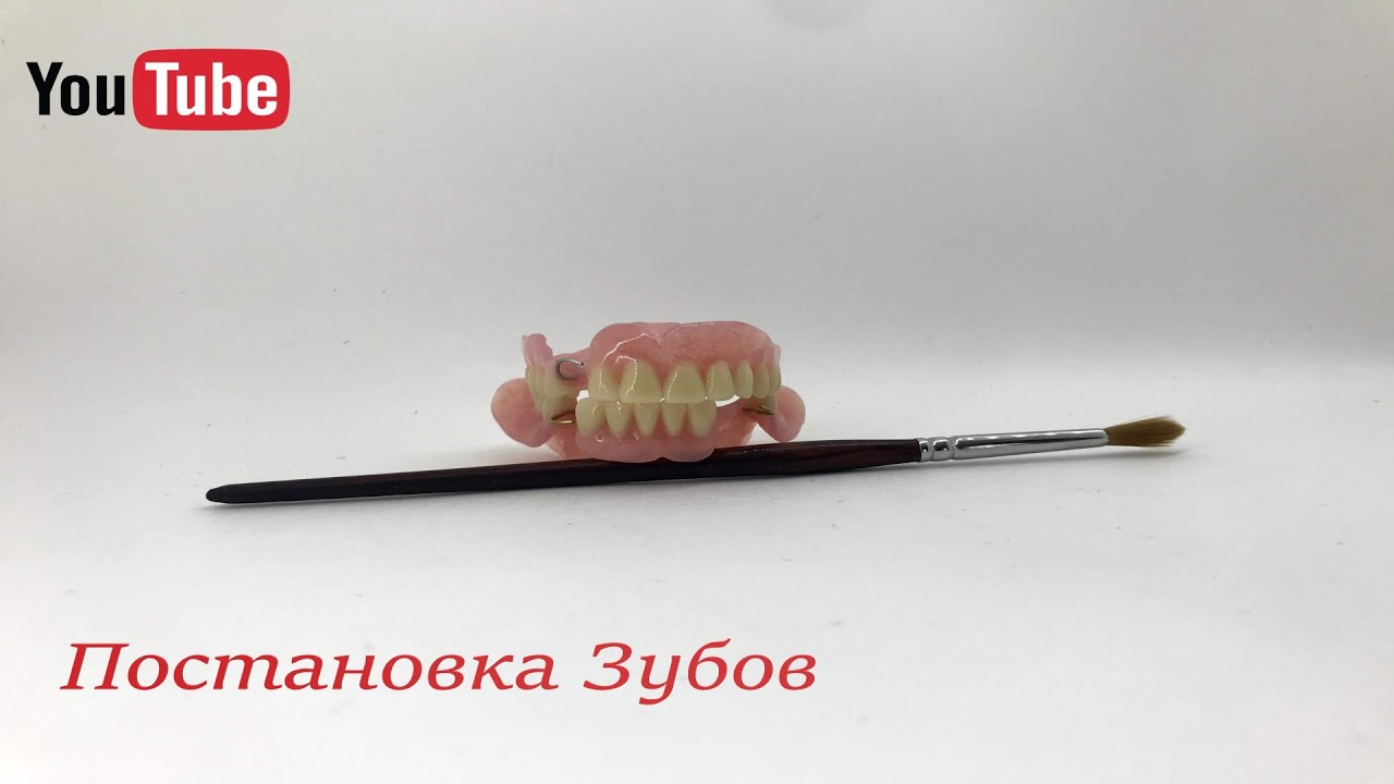 Зубные протезы Постановка | Staging denture