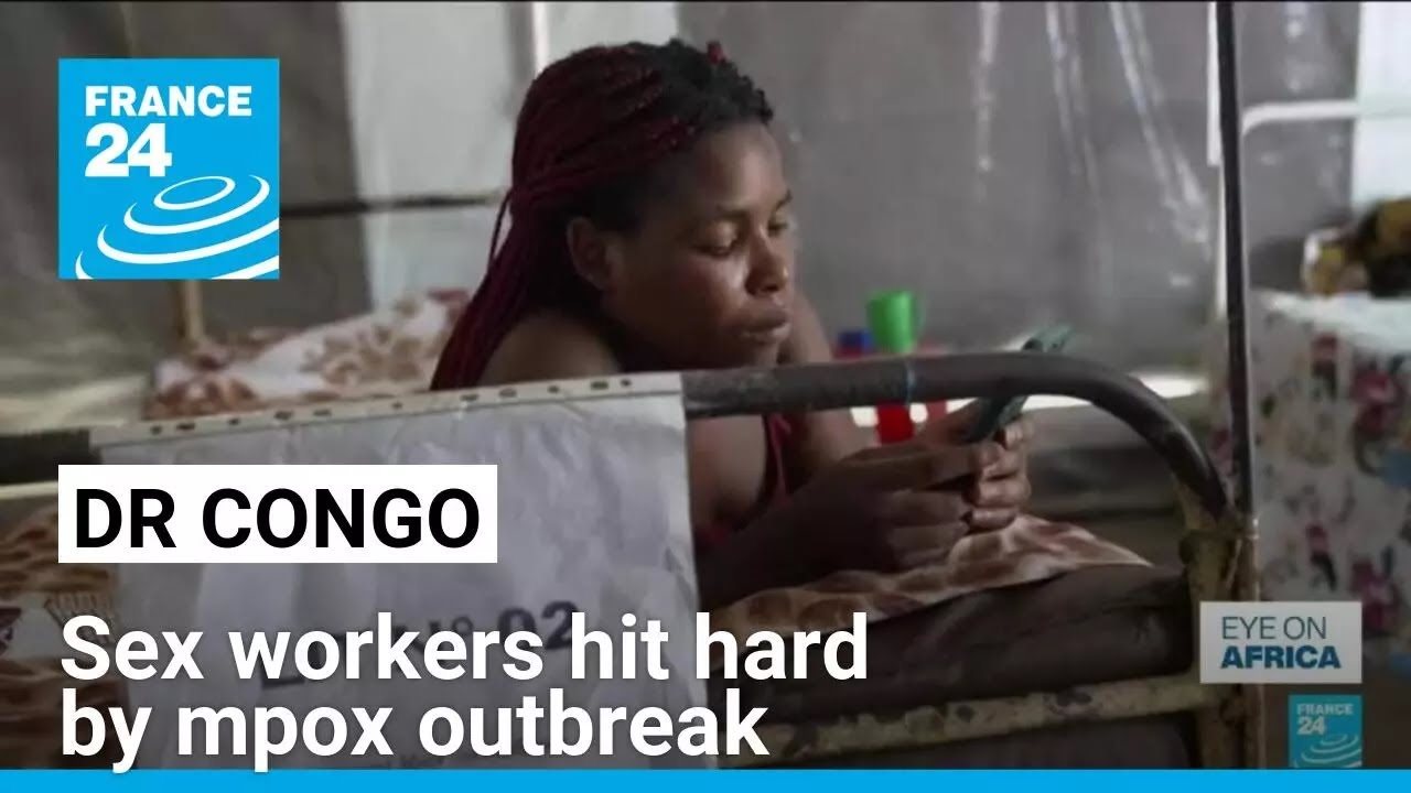 Sex workers hit hard by mpox outbreak in eastern DR Congo &bull; FRANCE 24 English