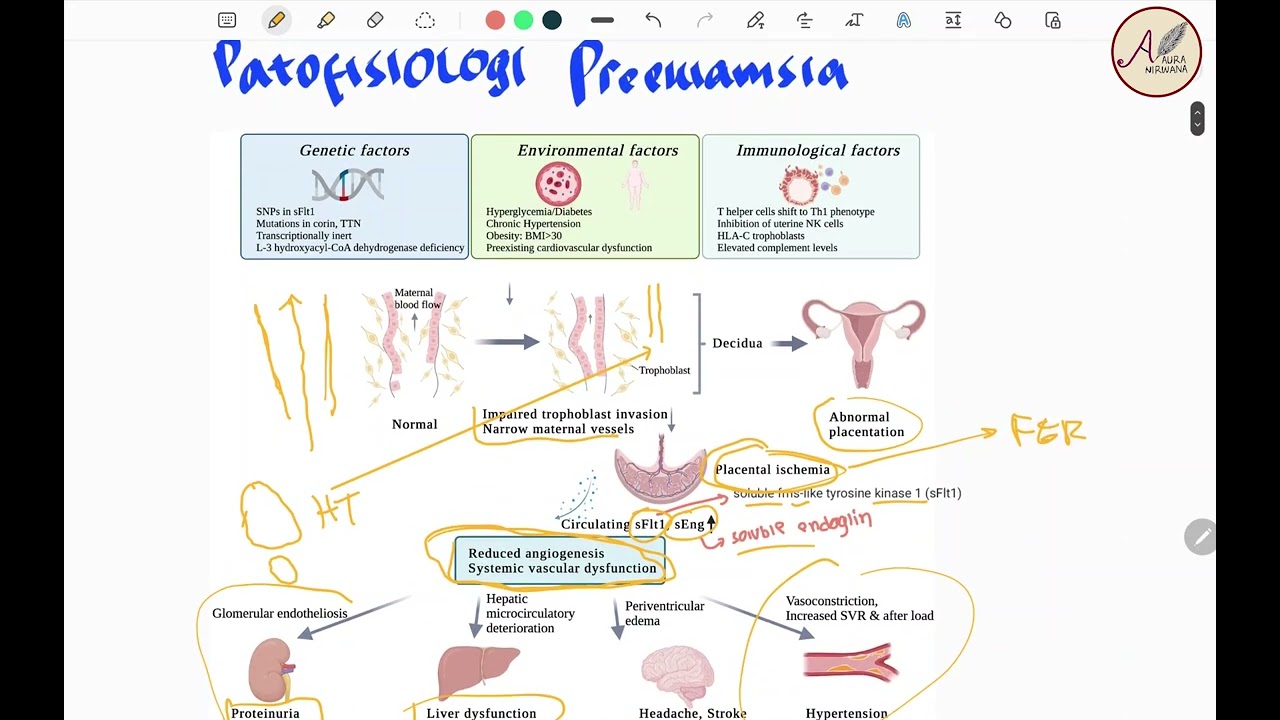 Preeklamsia Hipertensi Dalam Kehamilan - Patofisiologi, Diagnosis, Manajemen Persalinan dan Obat
