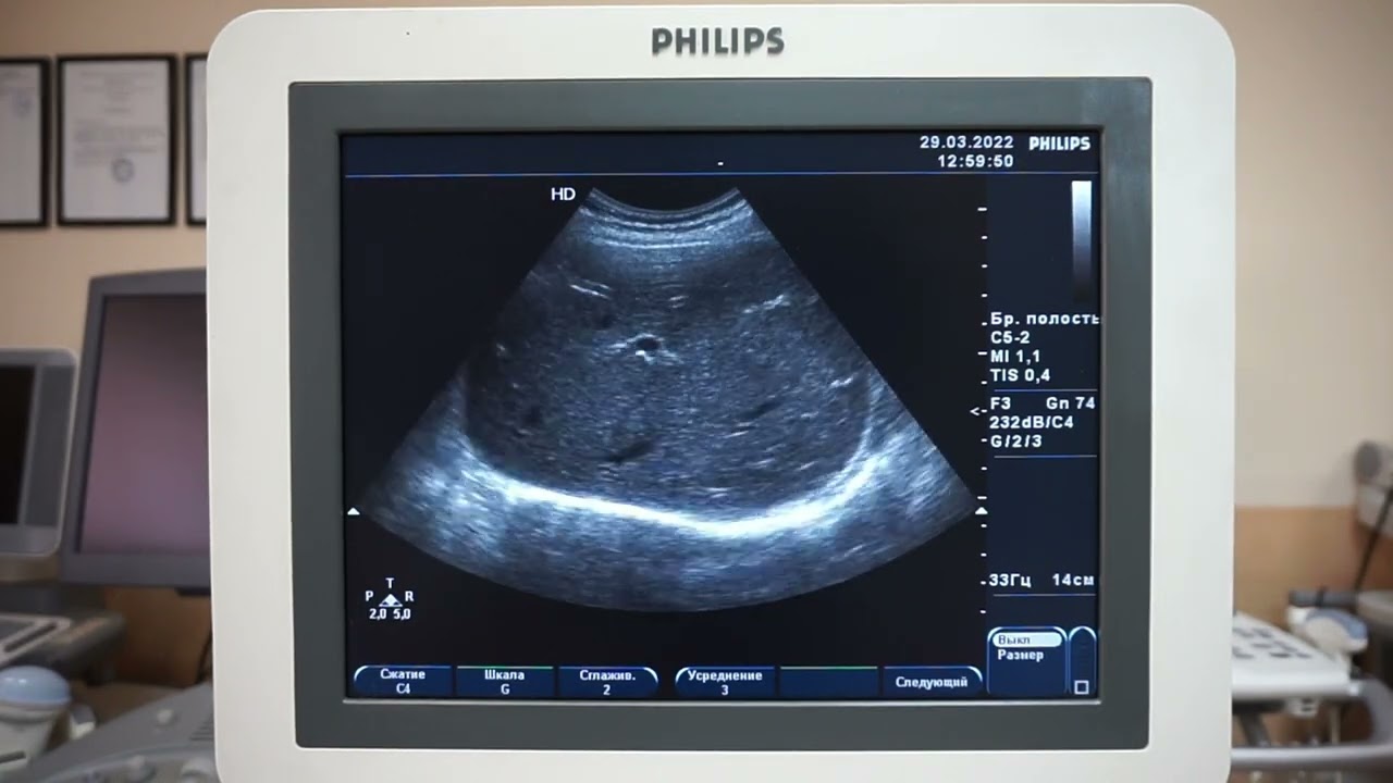 Philips HD7 обор ультразвукового сканера