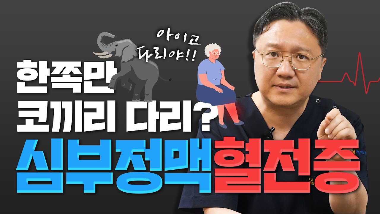 한쪽 다리만 붓는다?? 사망을 부르는 급성 심부정맥혈전증 치료법! 스텐트 I 풍선성형술 I 변승재 원장