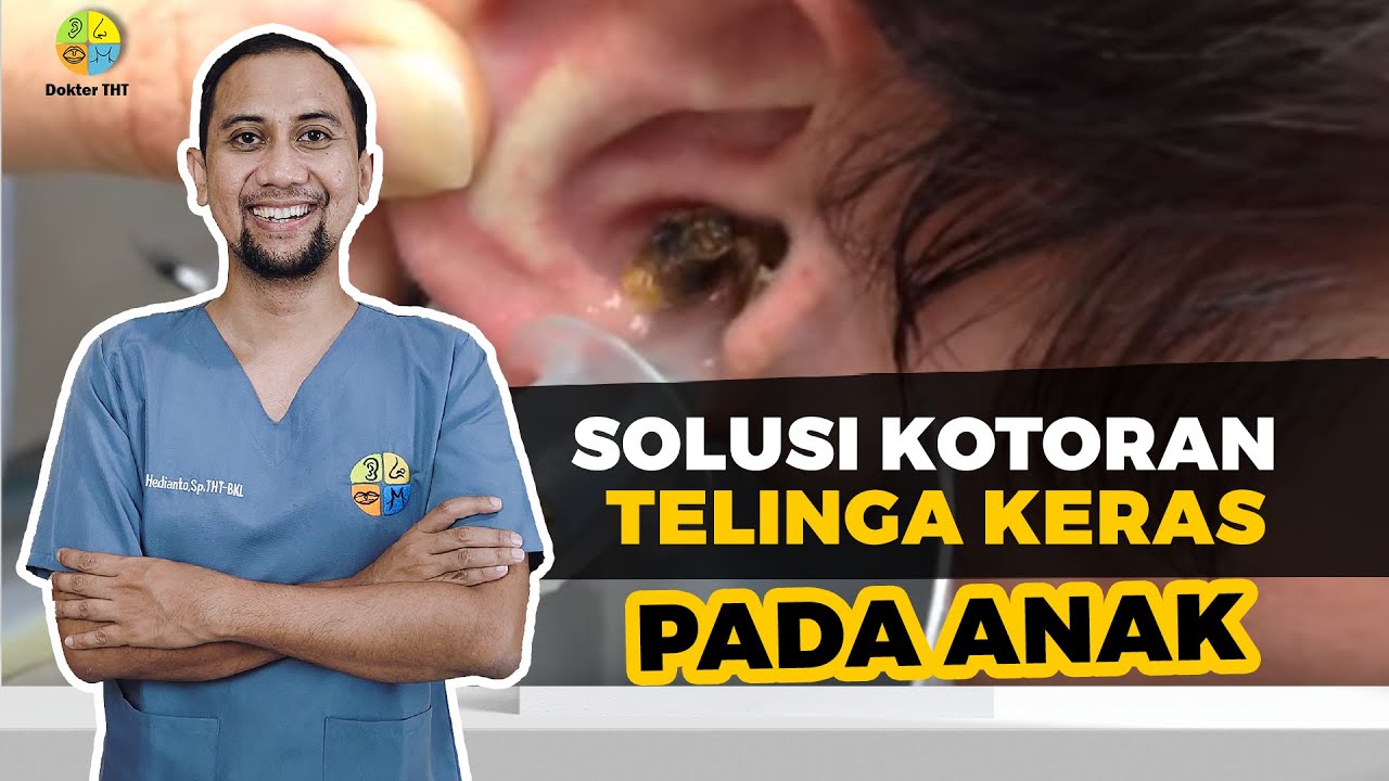 SOLUSI KOTORAN TELINGA KERAS PADA ANAK