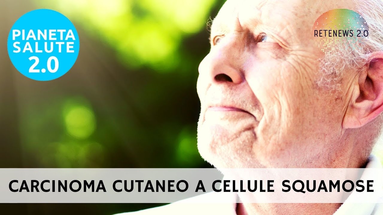 Carcinoma cutaneo a cellule squamose: diagnosi, terapie, innovazione.