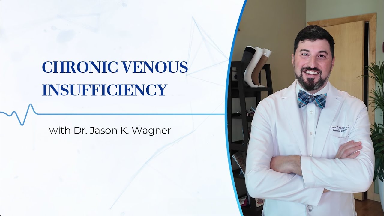 Why Your Legs Swell Understanding Chronic Venous Insufficiency (CVI)