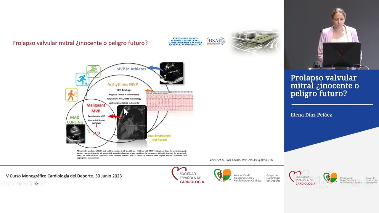 Prolapso valvular mitral, ¿inocente o peligro futuro?