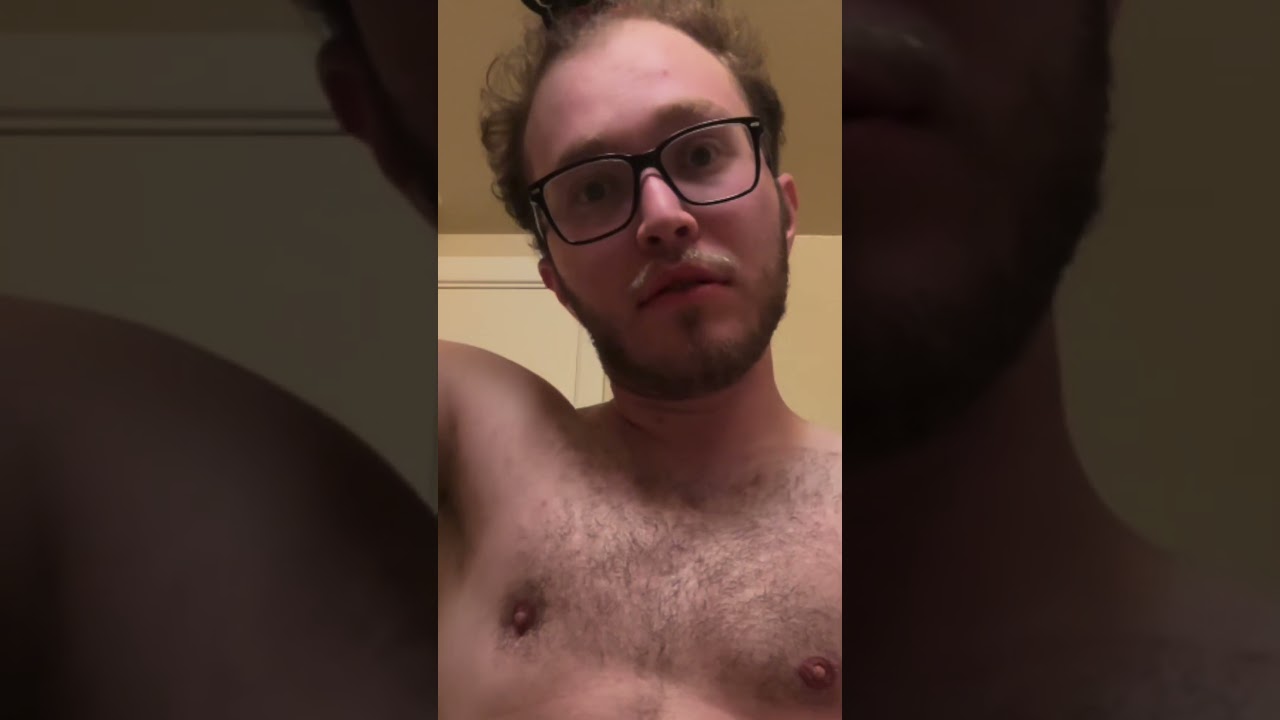 Balding Man 23 Has INSTANT Glow Up