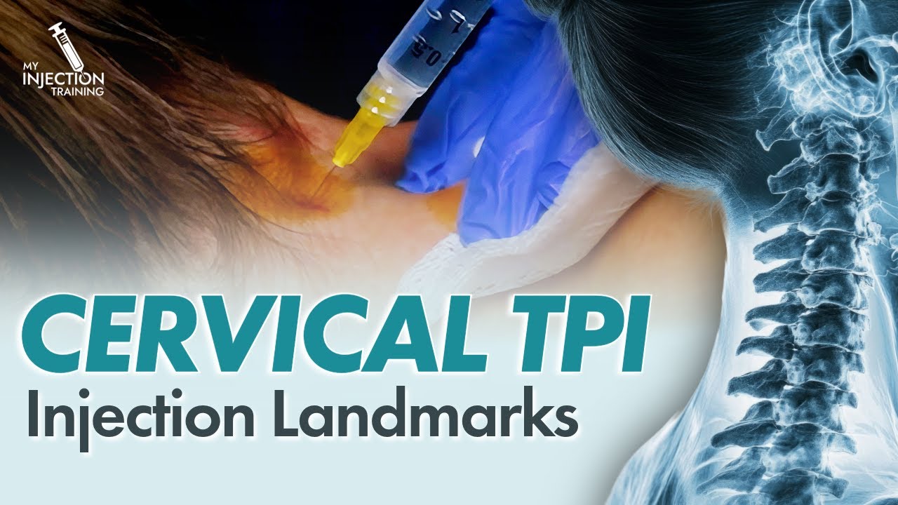 How to Perform Cervical Paraspinal Trigger Point Injections