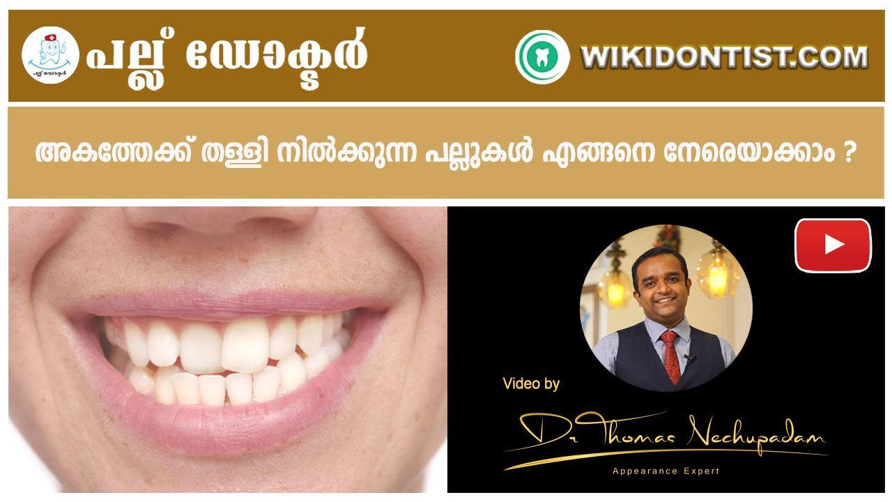 അകത്തേക്ക് തള്ളി നിൽക്കുന്ന പല്ലുകൾ എങ്ങനെ നേരെയാക്കാം