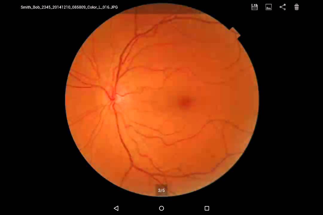 Topcon Nw-400 Android Tablet Tutorial