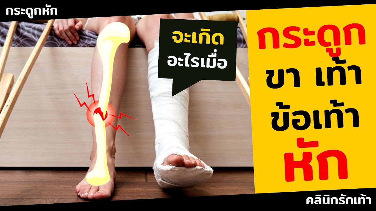 จะเกิดอะไรเมื่อ กระดูกเท้าหัก กระดูกขาหัก กระดูกข้อเท้าหัก และต้องดูแลอย่างไร