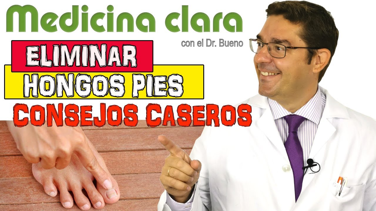 ELIMINAR LOS HONGOS EN PIES DESDE CASA | Medicina Clara