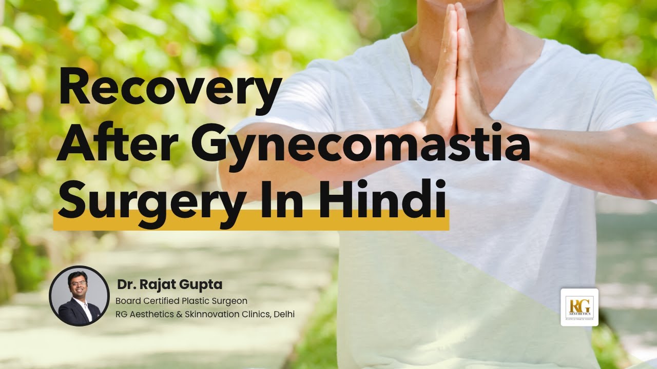 Gynecomastia Post Surgery Recovery | Gynecomastia Treatment in Hindi | Dr Rajat Gupta, Delhi