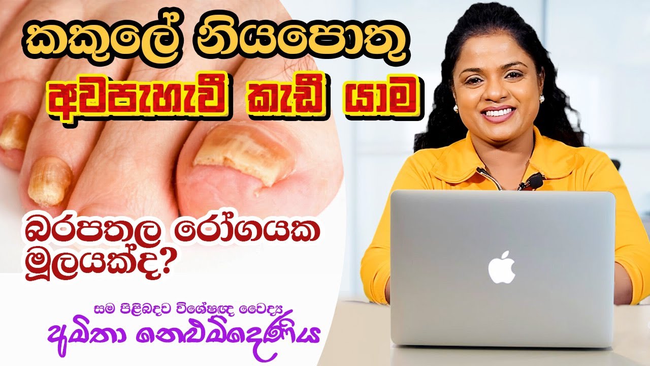 ඔබගේ කකුලේත් නියපොතු අවපැහැ ගැන්වී කැඩී තිබෙනවාද?