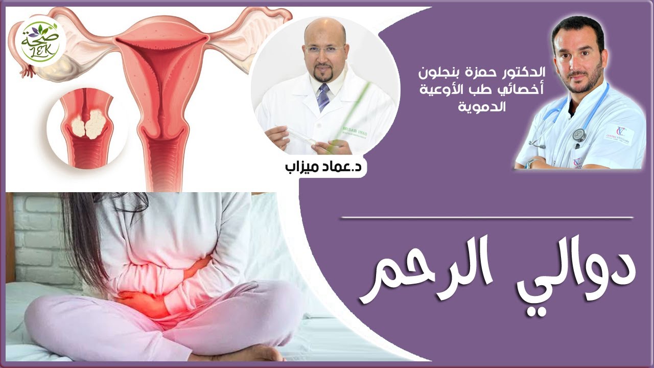 كيف يمكن علاج دوالي الرحم مع الدكتور حمزة بنجلون والدكتور عماد ميزاب IMAD MIZAB