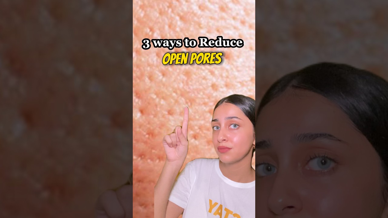 3 Ways to Reduce/Shrink Open Pores 💫😻 | Open pores remedies ✅ 