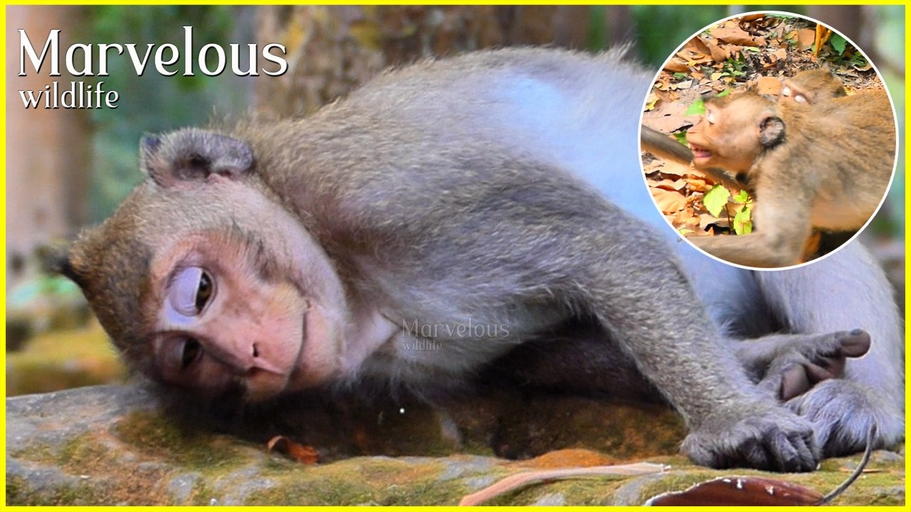 P@@r...!  Jonna's emotionally unstablee to accept, while the condition of the leg is p@inful