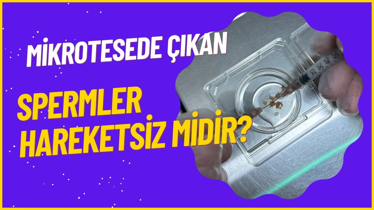 Mikrotesede çıkan spermler hareketsiz midir?