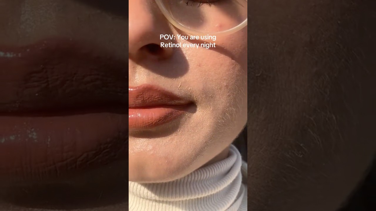 Skin peeling after using Retinol is common.